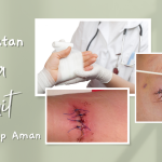 Perawatan Optimal Luka Jahitan